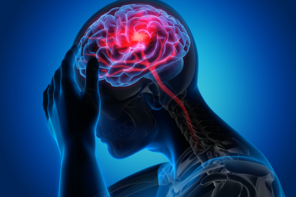 मस्तिष्काघातः ‘समयमै विशेषज्ञ उपचार पाए पूर्ववत् अवस्थामा फर्किन सकिन्छ’